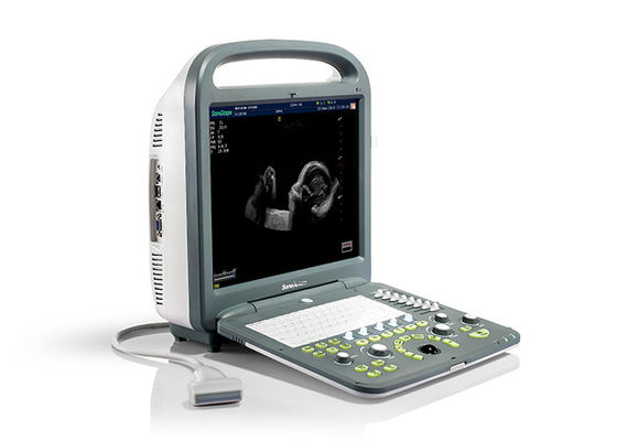 سیستم داپلر رنگی قابل حمل S2 Sonoscape Advanced Imaging Technology 320G